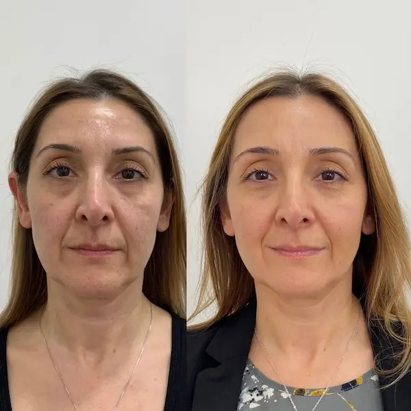 Testimonio de Carmen L.